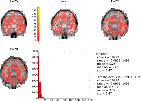 Simple plotting facility for (f)MRI. F-scores